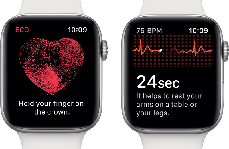 photo of Apple Watch ECG Feature Likely Coming Soon to Japan and Brazil image