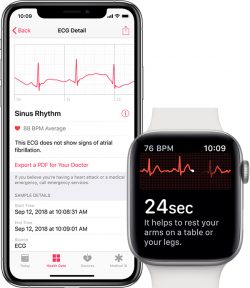 iphone apple watch ecg