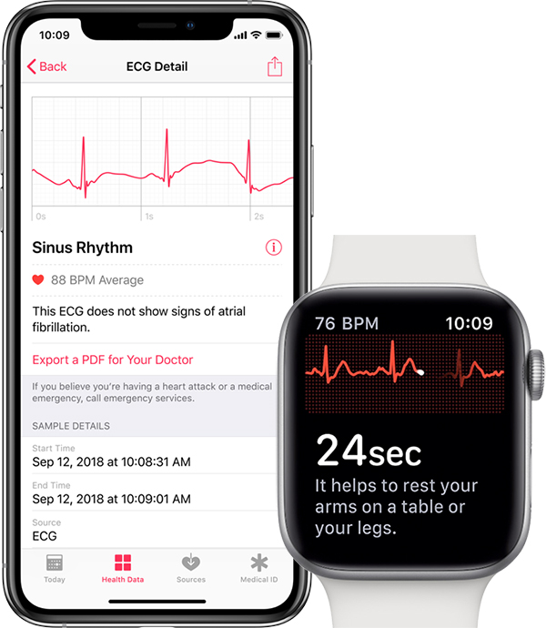 Ekg apple watch series 6 new arrivals