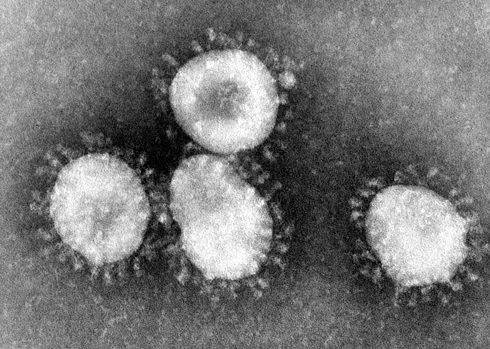 1600px Coronaviruses 004 lores