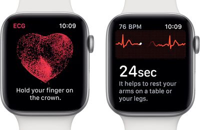 applewatchseries4ecgfeature