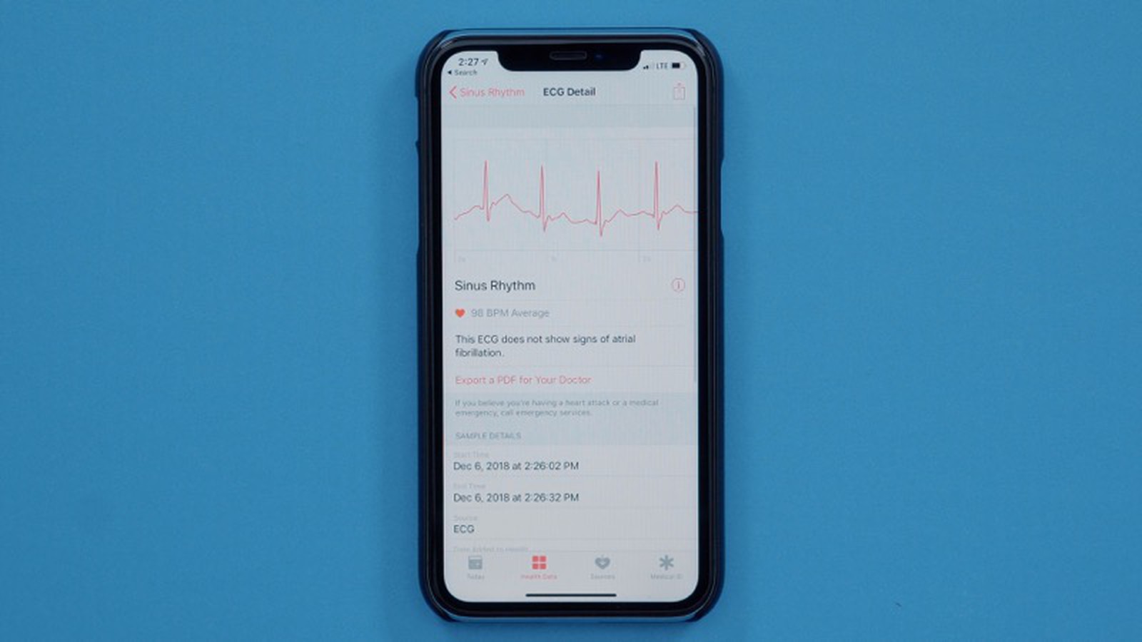 ecg app on apple watch 4