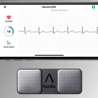 kardiamobile alivecor
