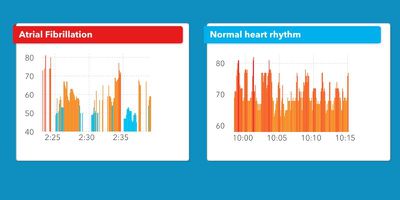 cardiogramalgorithm