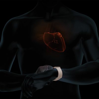 apple watch ecg