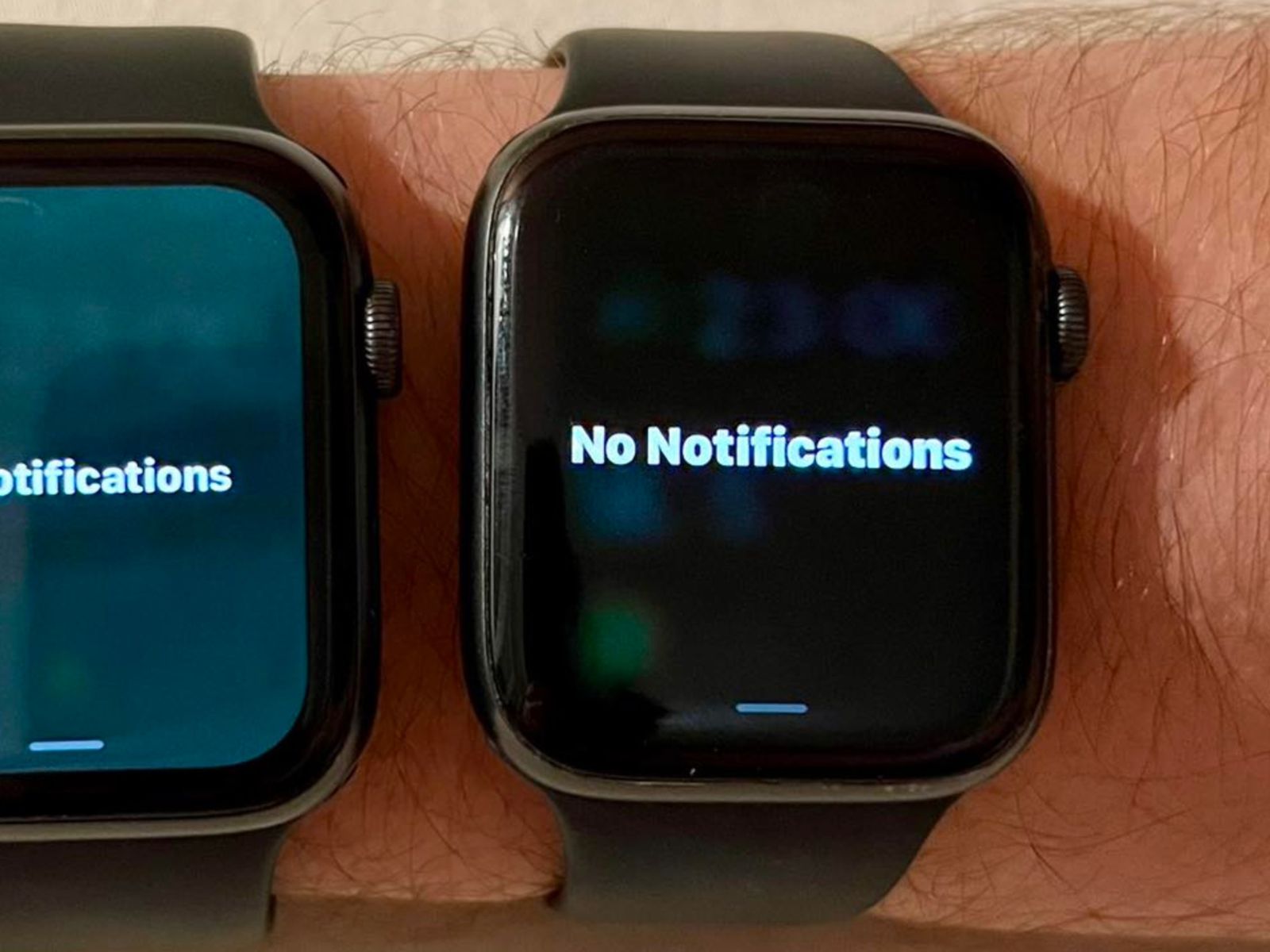 Some Apple Watch Users Complain of Odd Green Screen Tint Following