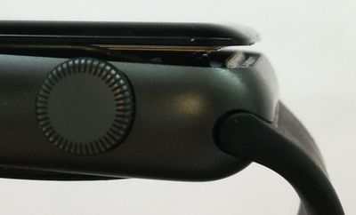 apple watch expanded battery