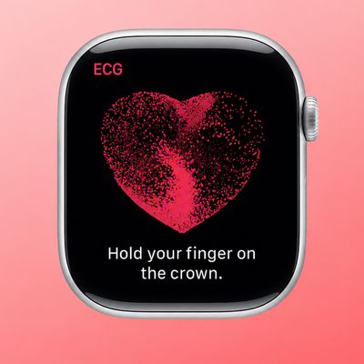 Apple Watch ECG