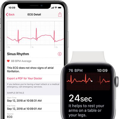 iphone apple watch ecg