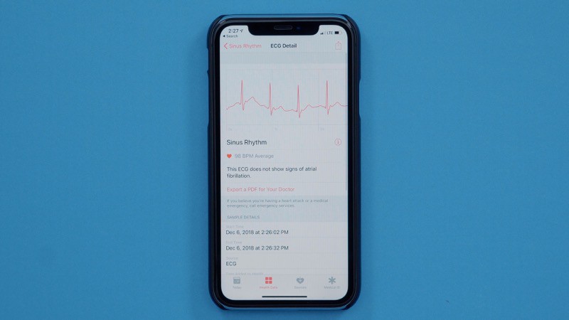 no ecg app on apple watch 4