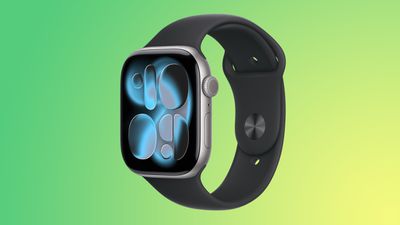 apple watch series 11 green 2