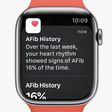 watchos 9 afib history