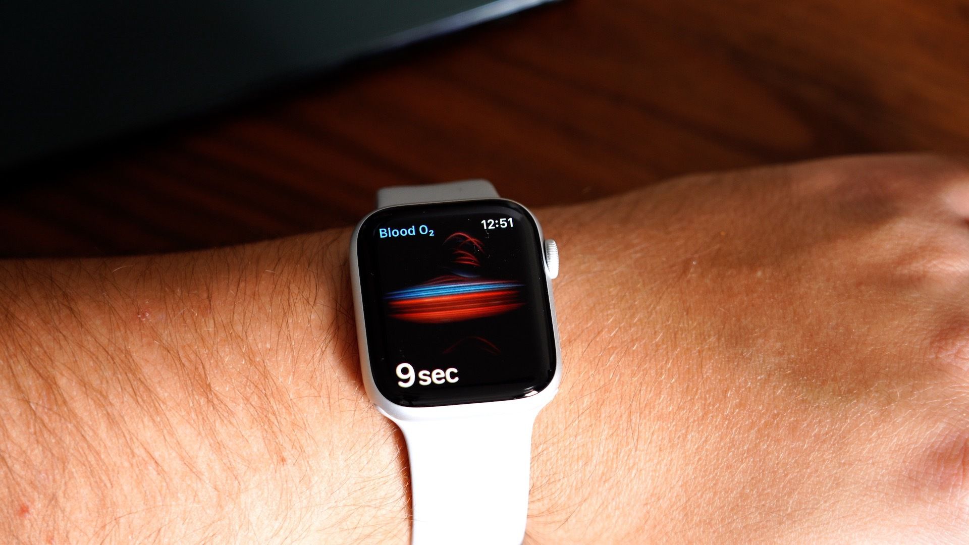 Apple Watch may track blood sugar levels, other health features