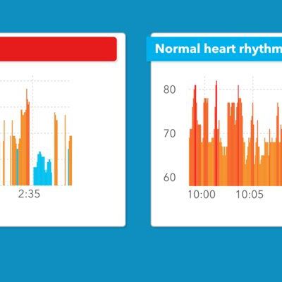 cardiogramalgorithm