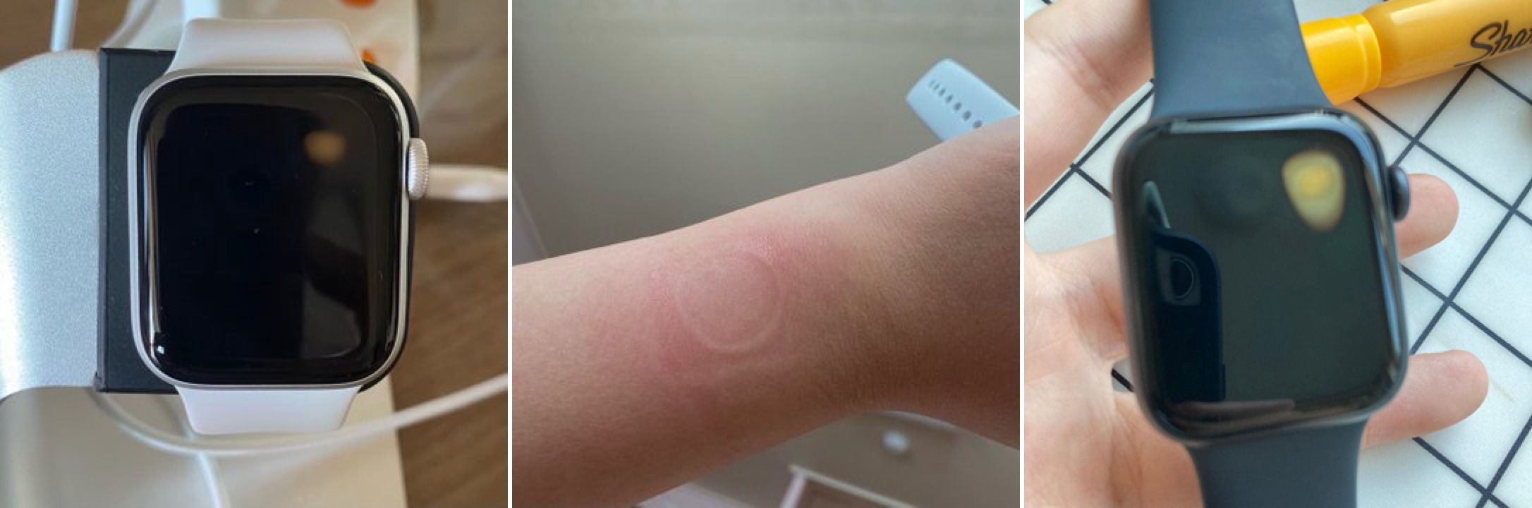 Some Apple Watch SE Owners Experiencing Issues With Overheating ...