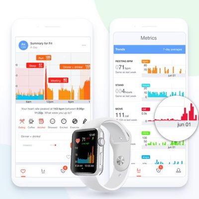 cardiogram