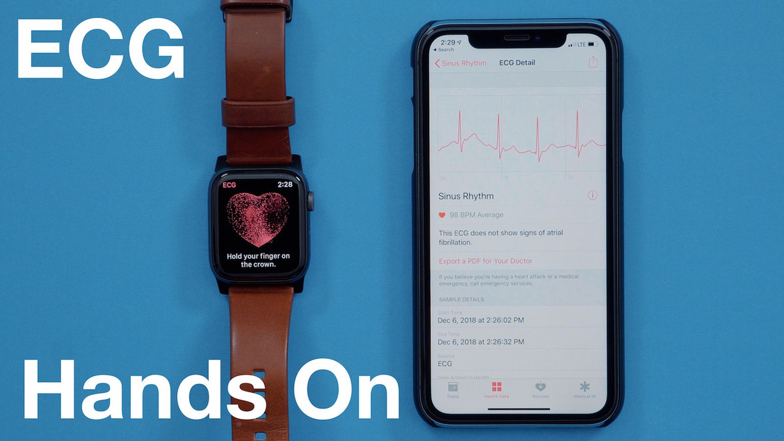 watchOS 26: Fix songs not downloading on Apple Watch Apple watch series 4 -GPS and cellular data! main image 2