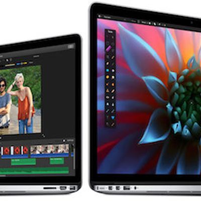 mbp retina