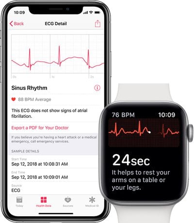 iphone apple watch ecg