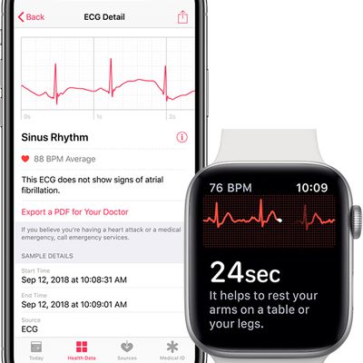 iphone apple watch ecg