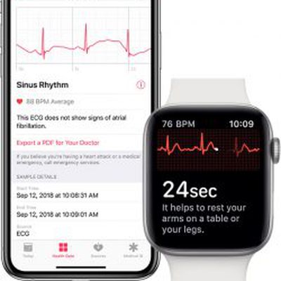 iphone apple watch ecg