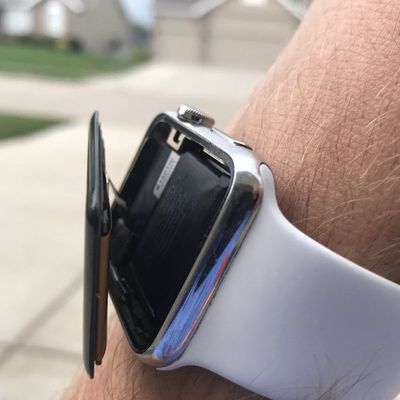 apple watch swollen