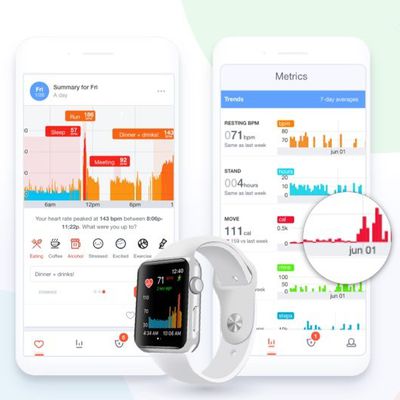 cardiogram