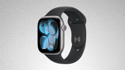 apple watch series 11 glitter