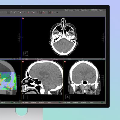 studio display xdr medical presets
